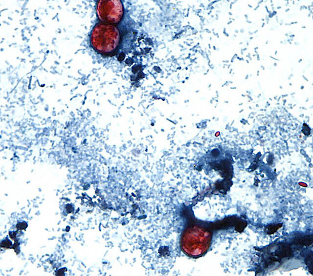 Diarrhea-causing parasite infections are confirmed in Allegheny County